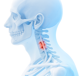 neck_b3