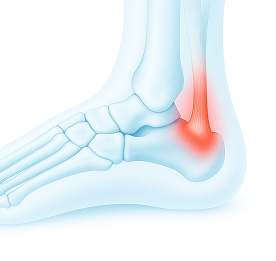knee_b2