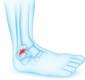 knee_b4