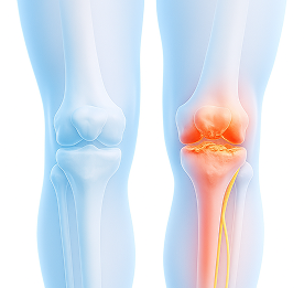 knee_b1