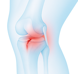 knee_b2