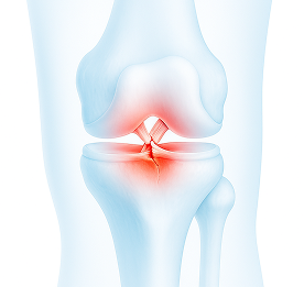 knee_b3