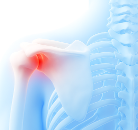 shoulder_b1